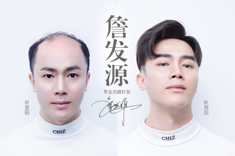 怎样解决脱发的现象